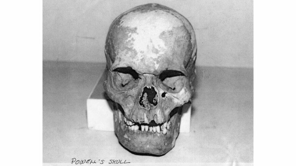 Lewis Powell skull via WikiCommons.